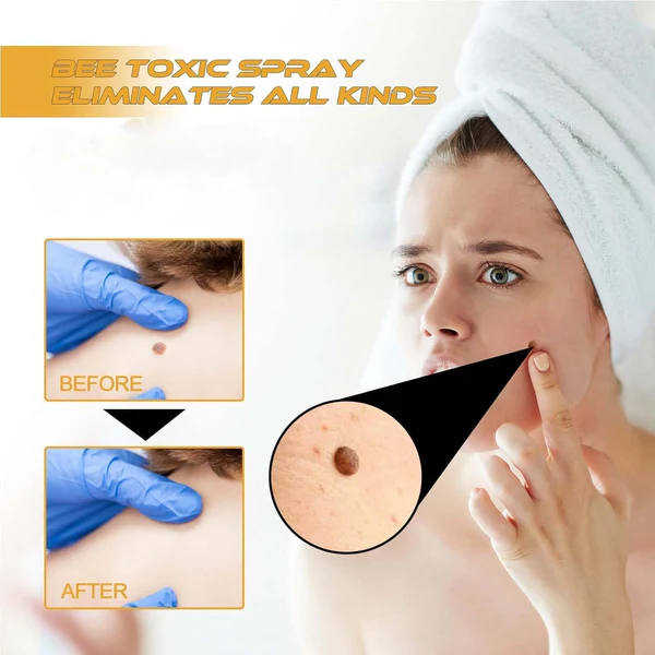 Bee Venom Tag Remover Spray - Image 4
