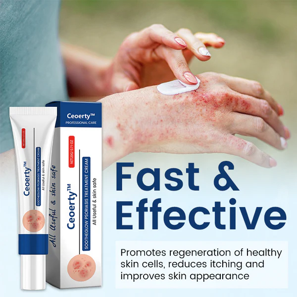 SootheGlow Psoriasis Treatment Cream - Image 4