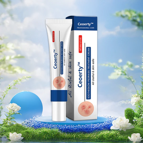 SootheGlow Psoriasis Treatment Cream