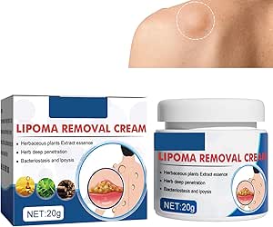 LIPOMA REMOVAL CREAM (IMPORTED)