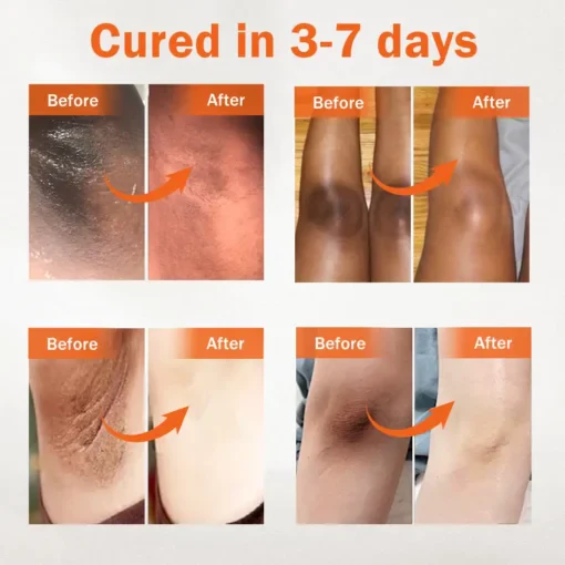 Oil Against Dark Spots & Acanthosis - Image 3