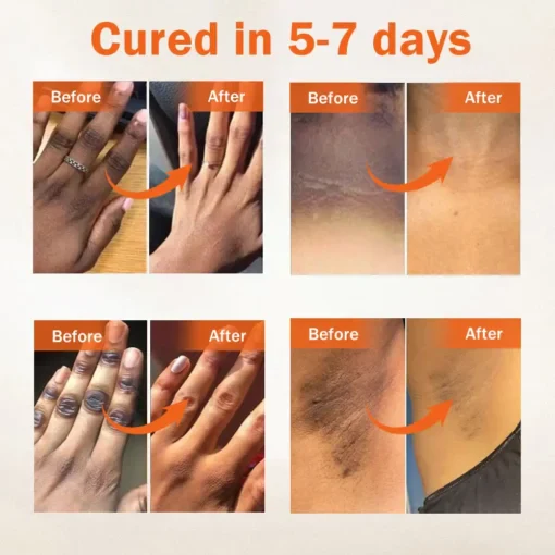Oil Against Dark Spots & Acanthosis - Image 5