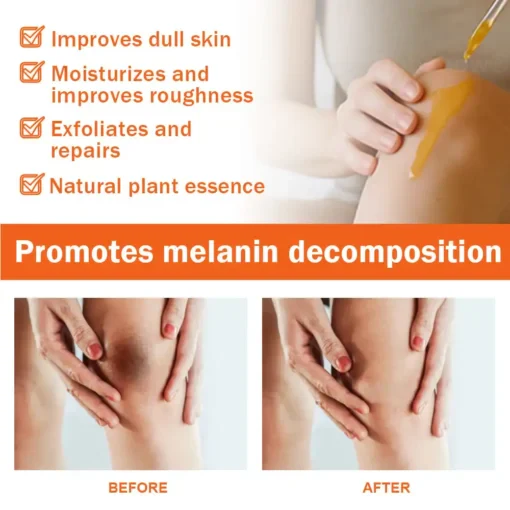 Oil Against Dark Spots & Acanthosis - Image 9