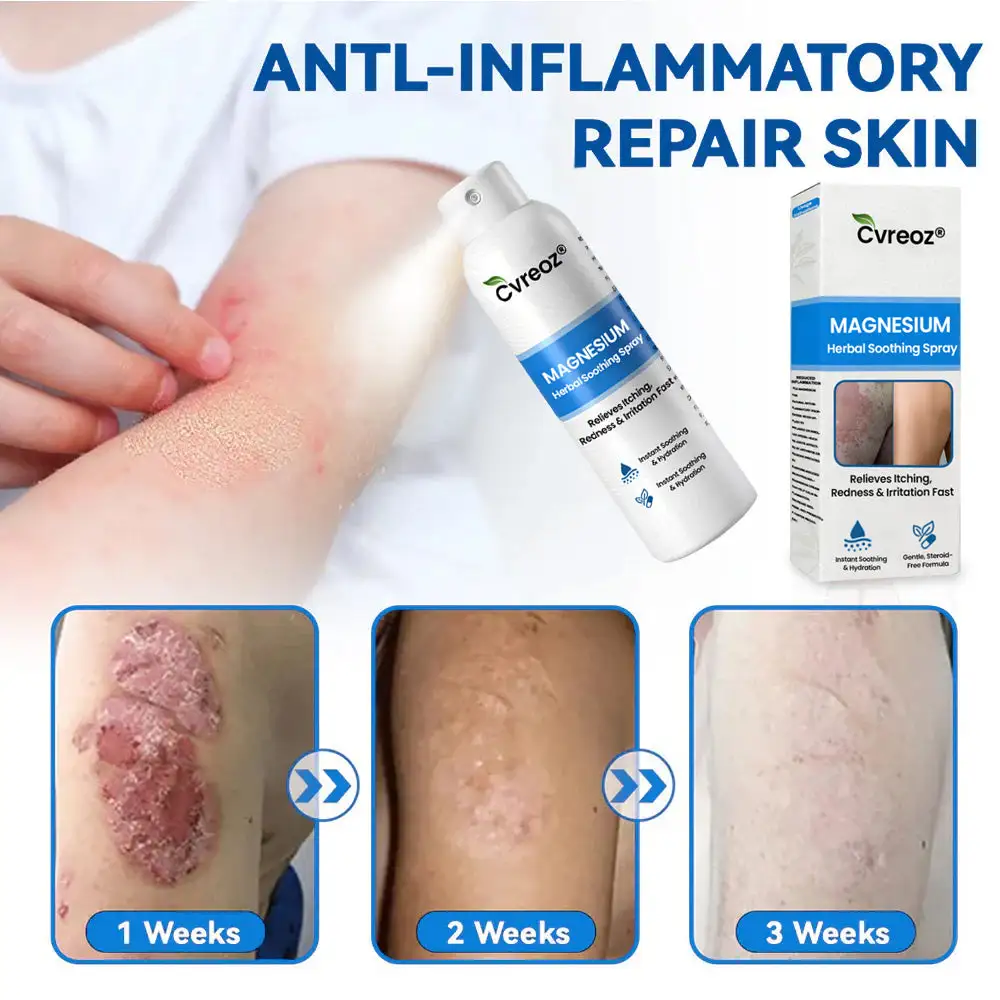 Cvreoz® Magnesium Herbal Psoriasis Spray ( Imported ) - Image 8