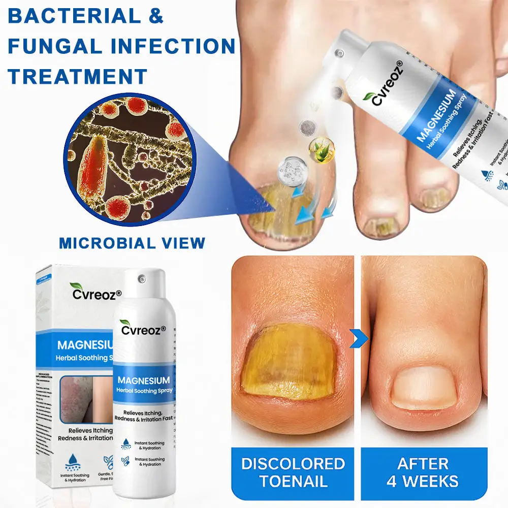 Cvreoz® Magnesium Herbal Psoriasis Spray ( Imported ) - Image 5